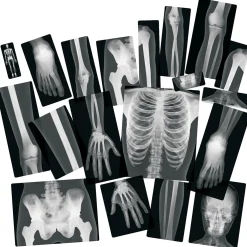 Human X-Rays